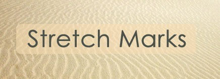 stetch marks