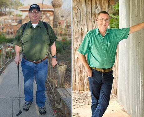 Before and after pictures of Mike Jantz, bariatric surgery patient to help illustrate what is the best weight loss surgery|An illustration on how a gastric band or lap band works to help illustrate best weight loss surgery.