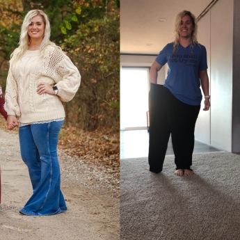 A before and after picture of a woman, showing incredible weight loss by showing how large the pants are after losing weight as one of the 10 Surprising Benefits of Bariatric Surgery You Need to Know